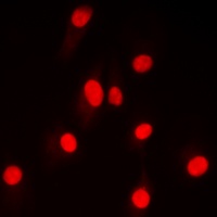 NF-kappaB p100 (phospho-S865) antibody