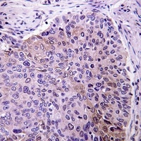 Anti-pro-NGF beta Antibody