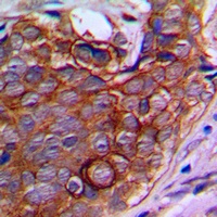 Anti-NPDC1 Antibody