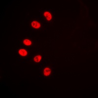 Anti-NR2F2 Antibody