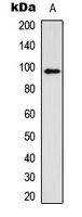 Glucocorticoid Receptor (Phospho-S211) Antibody