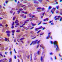 Glucocorticoid Receptor (Phospho-S211) Antibody
