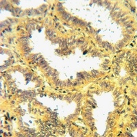 Anti-NRG4 Antibody