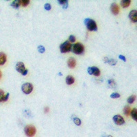 Anti-NRIP2 Antibody