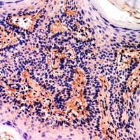 Anti-CD73 Antibody