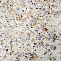 Anti-OVOL1 Antibody