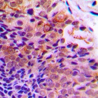 Anti-PDCD4 (Phospho-S457) Antibody