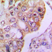 Anti-PDHA1 Antibody