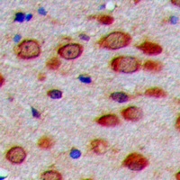 Anti-PEX11G Antibody