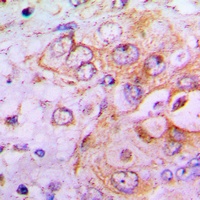 Anti-PFKFB2 Antibody
