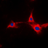 Anti-PFKFB2 Antibody