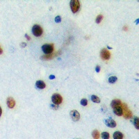 Anti-PIAS4 Antibody
