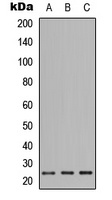 PIGF Rabbit Polyclonal Antibody