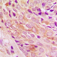 PI3K p110 alpha Antibody
