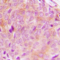 Anti-PLC gamma 2 Antibody