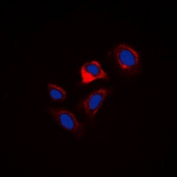 Phospholamban (phospho-S16/T17) antibody