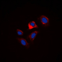 Anti-Phospholamban (Phospho-S16/T17) Antibody