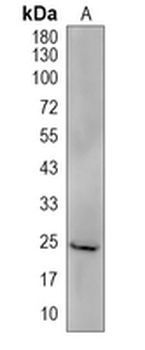 TMEM86B Rabbit Polyclonal Antibody
