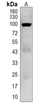 LARS2 Rabbit Polyclonal Antibody