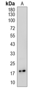 EDN2 Rabbit Polyclonal Antibody