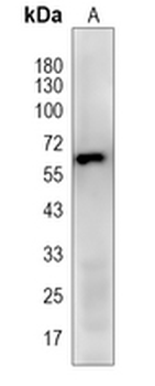 c-Fos (Phospho-T232) Rabbit Polyclonal Antibody