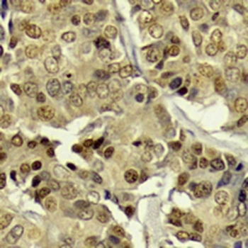 c-Fos (Phospho-T232) Rabbit Polyclonal Antibody