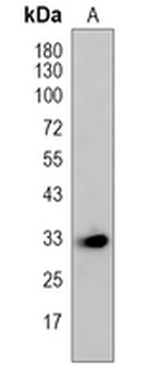 RNASEH2A Rabbit Polyclonal Antibody