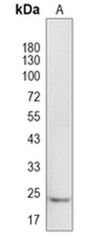 ZFAND5 Rabbit Polyclonal Antibody