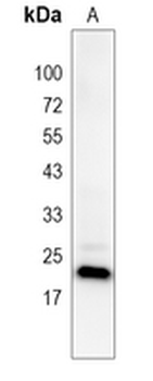 TSPAN13 Rabbit Polyclonal Antibody