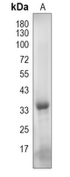 OR6N2 Rabbit Polyclonal Antibody