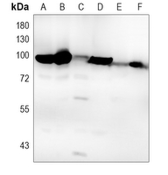 FOXO3 (Acetyl-K569) Rabbit Polyclonal Antibody