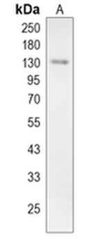 XPO1 Rabbit Polyclonal Antibody