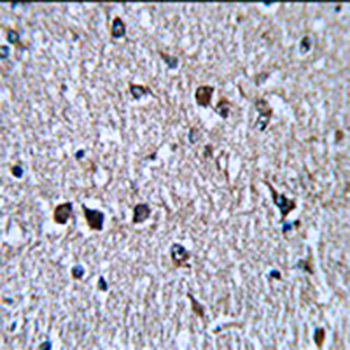 XPO1 Rabbit Polyclonal Antibody
