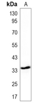 Pim-1 Rabbit Polyclonal Antibody