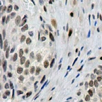 Pim-1 Rabbit Polyclonal Antibody