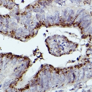 Giantin Rabbit Polyclonal Antibody