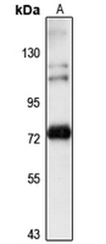 ZNF699 Rabbit Polyclonal Antibody