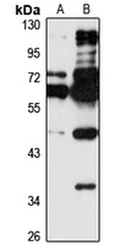 ZNF597 Rabbit Polyclonal Antibody