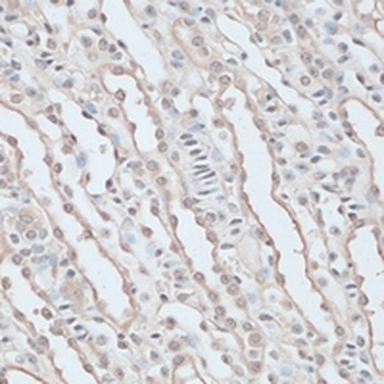 ZNF597 Rabbit Polyclonal Antibody