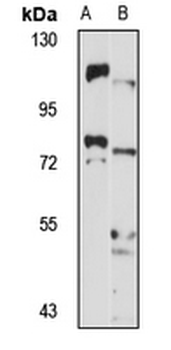 ZDHHC8 Rabbit Polyclonal Antibody