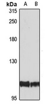 ZC3HAV1 Rabbit Polyclonal Antibody