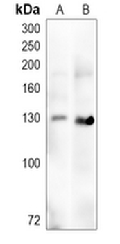 ZBTB38 Rabbit Polyclonal Antibody