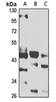 ZBTB25 Rabbit Polyclonal Antibody