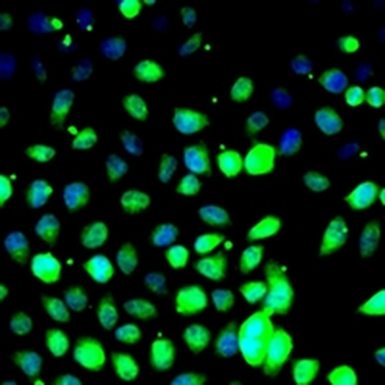ZBTB25 Rabbit Polyclonal Antibody