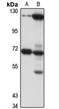 YTHDF2 Rabbit Polyclonal Antibody