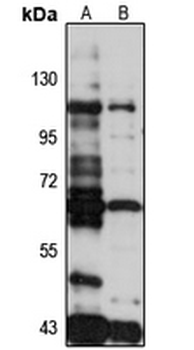 USP53 Rabbit Polyclonal Antibody