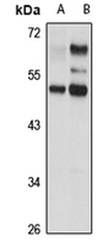 LBP1 Rabbit Polyclonal Antibody