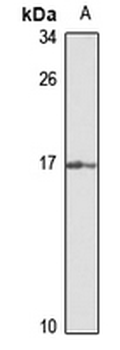 Dim2 Rabbit Polyclonal Antibody