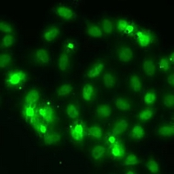 Dim2 Rabbit Polyclonal Antibody