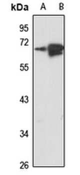 TSPAN33 Rabbit Polyclonal Antibody